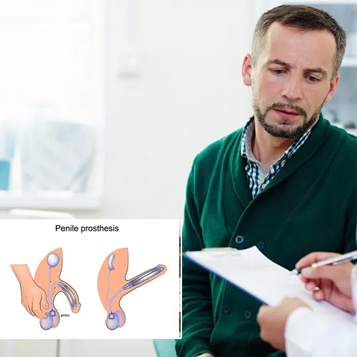 Why Choose   Urology Austin

for Your Penile Implant?